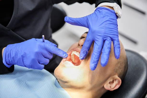 Best Dentist for Tooth Abscess  in North Wilkesboro, NC