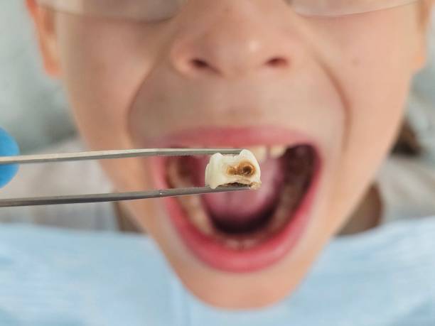 Best Broken Tooth Emergency  in North Wilkesboro, NC